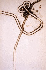 A laboratory photograph of the microscopic Ebola virus.