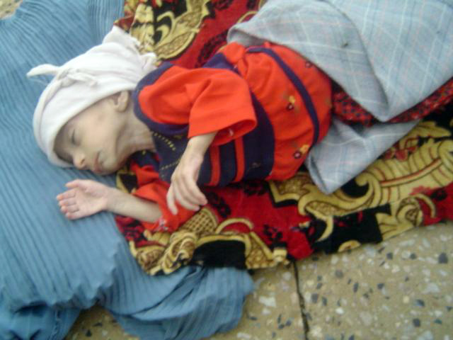 A diarrhoea patient in Heart city hospital.