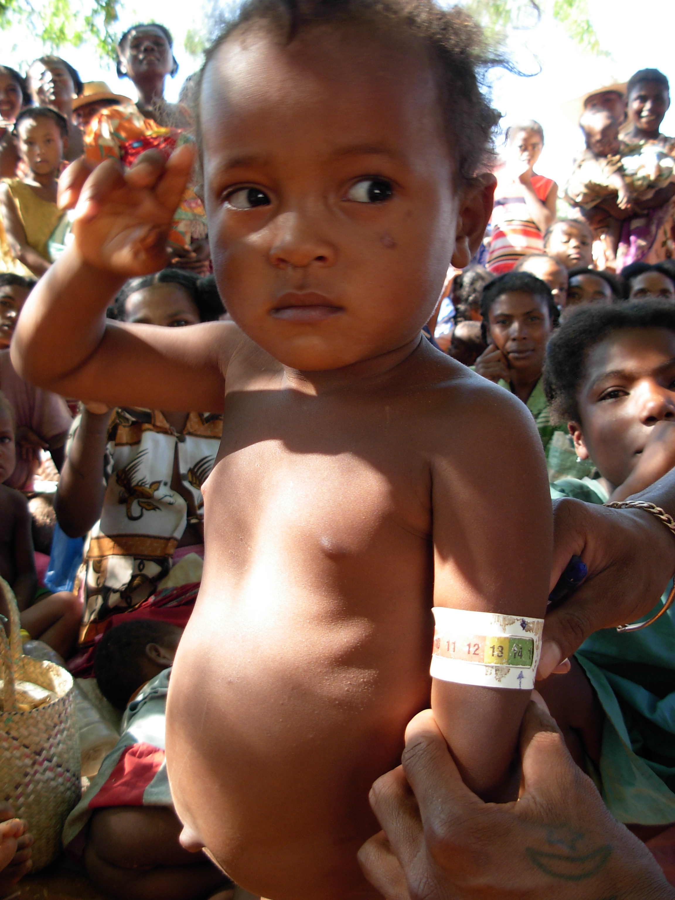 MUAC - Madagascar.