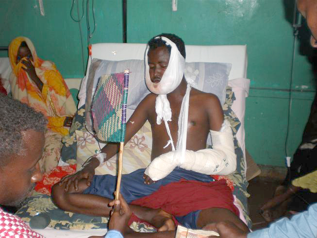 A young man injured in the fighting in Mogadishu recovering at Medina hospital