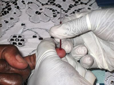 A home HIV test