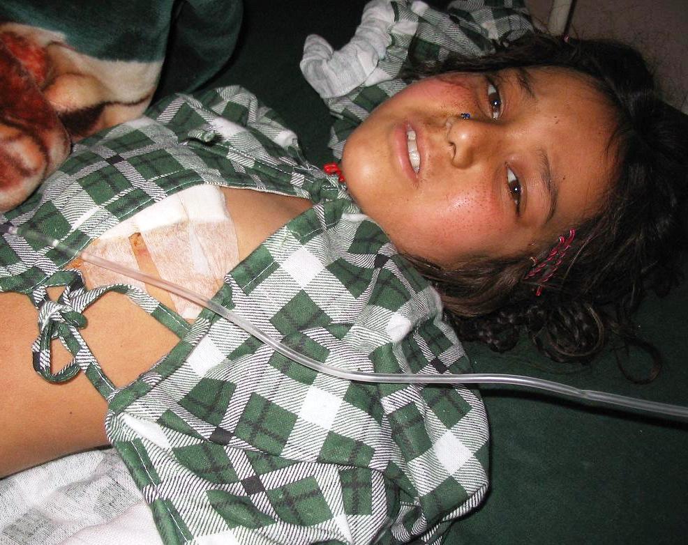 Children suffer the brunt of war in Afghanistan