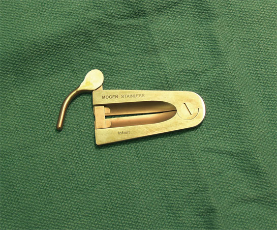The Mogen Clamp, used for male circumcision
