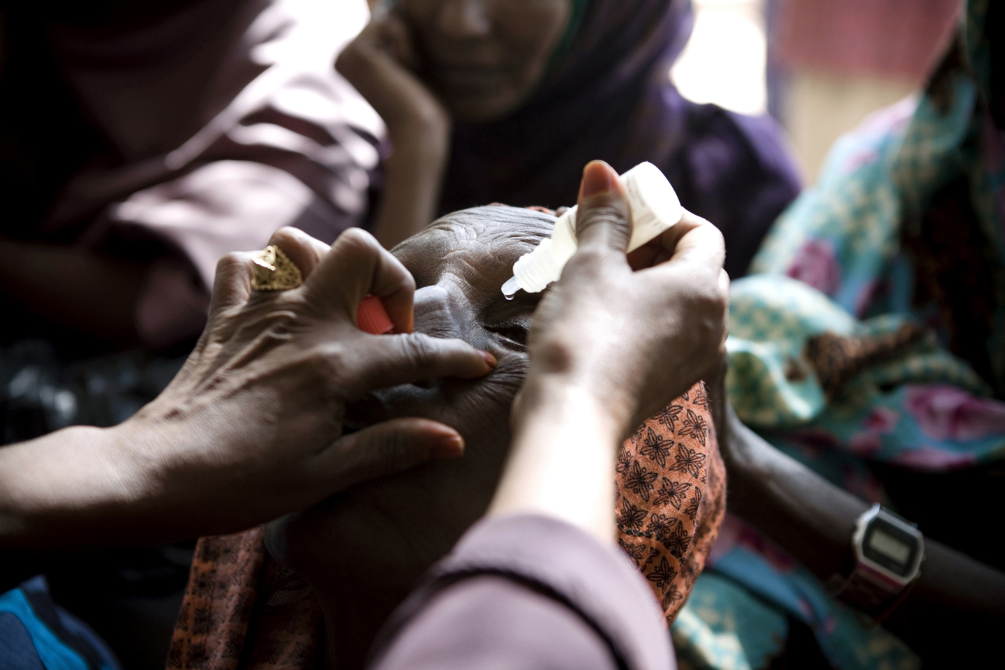 A nurse puts eye drops in a patient's eyes prior to the biometry test that will conclude what kind of artificial lens will suit the person during an eye surgery camp at the MSF hospital in Galcayo South in Puntland, Somalia on March 22, 2011. This is the