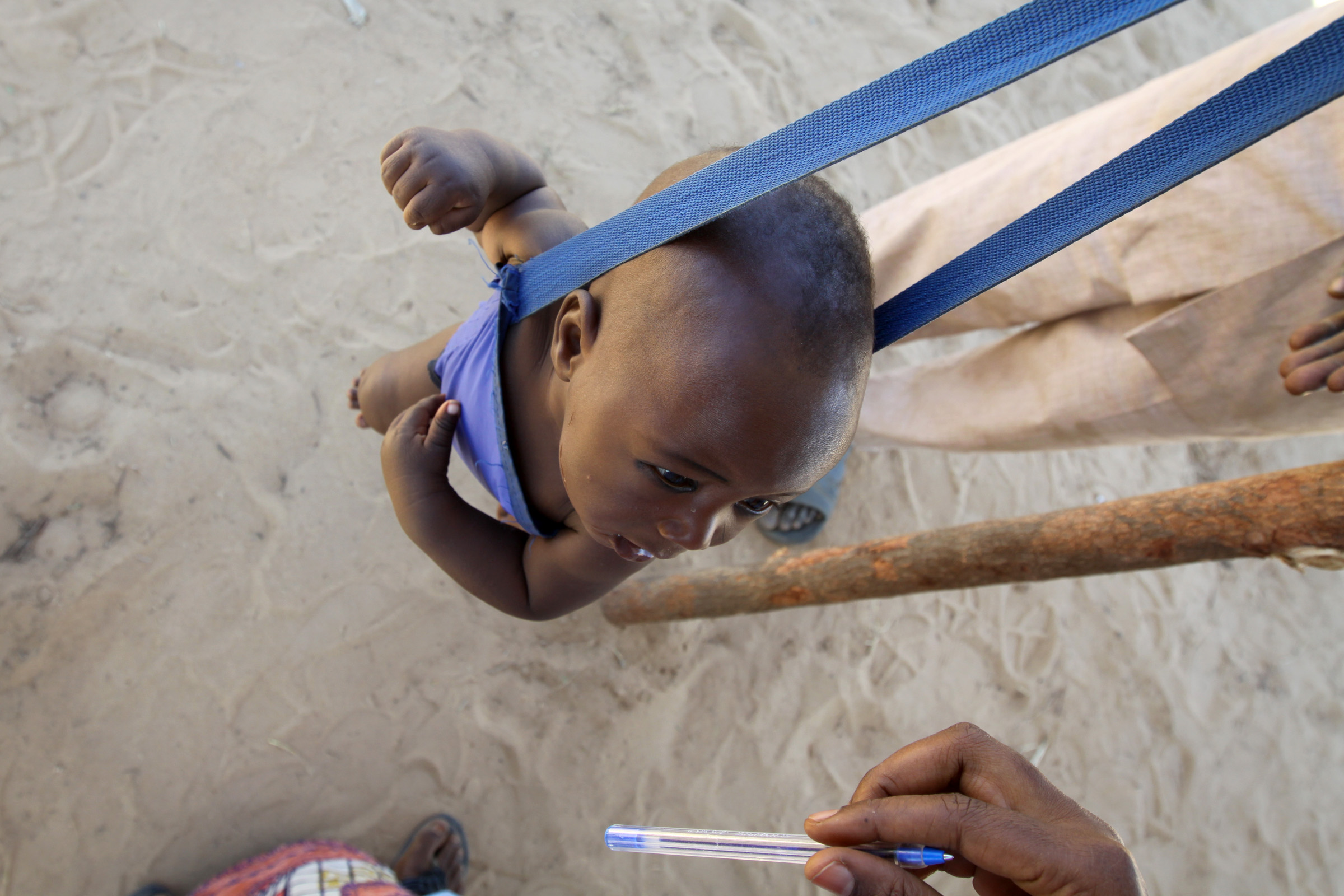 A young child being measured for signs of malnutrition in World Food Programme run therapeutic feeding center near Maradai, Niger