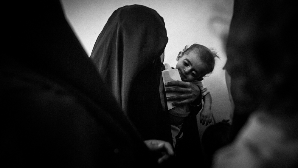 Mother and child wait for attendance at a hospital that assists malnourished children in the impoverished area of Bayt al-Faqih, Yemen