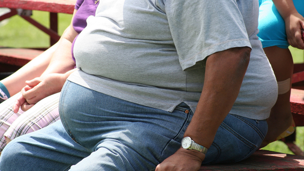 Obesity. For generic use