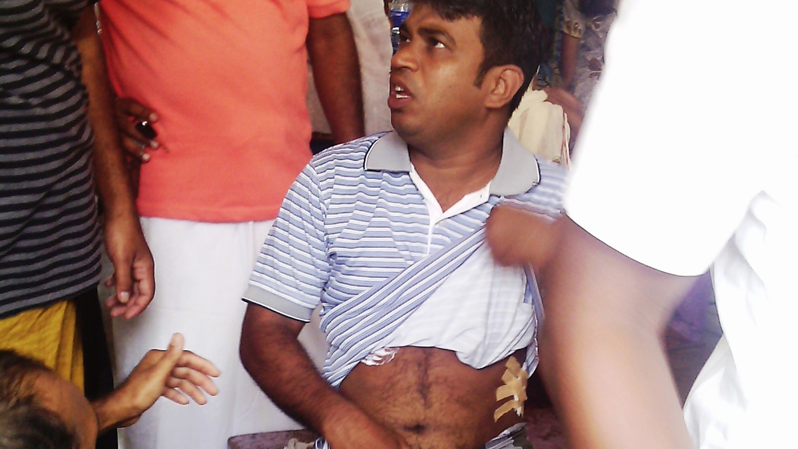 A man injured in communal violence between Muslims and Buddhists in Sri Lanka, which broke out after years of simmering tensions.