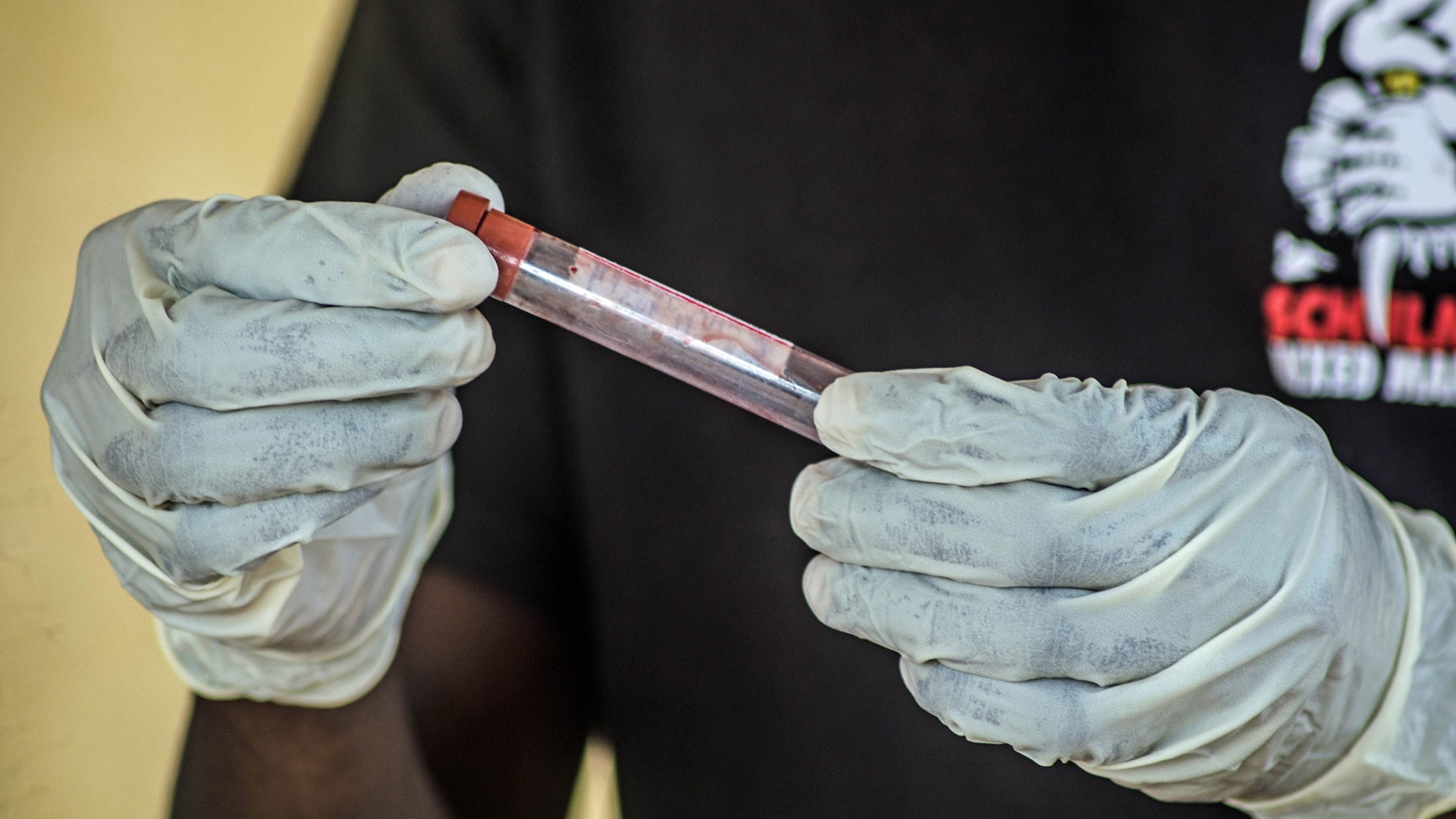 A health worker checks a blood sample for Ebola at Kenema government hospital, Sierra Leone