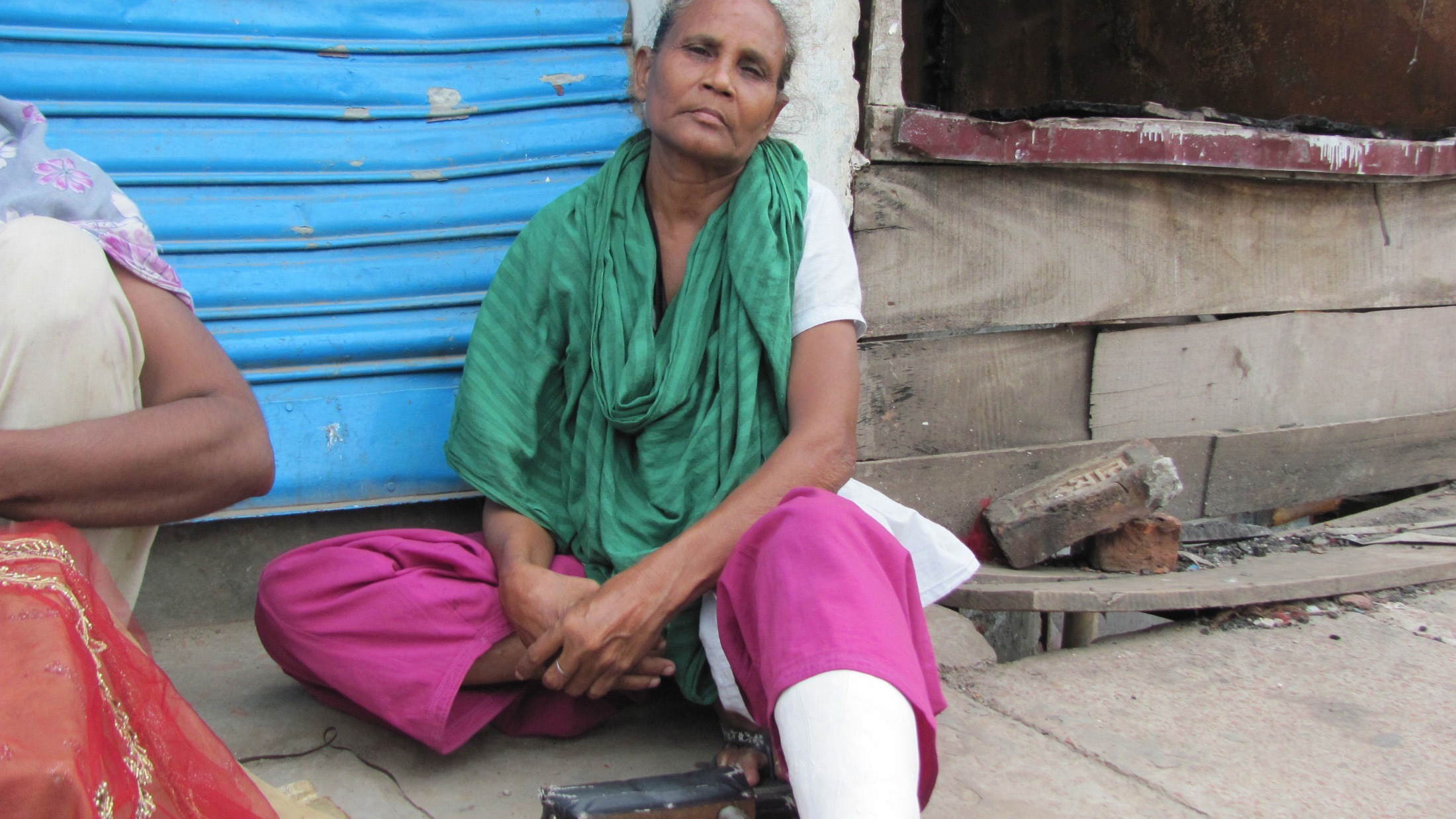 Anwari Begum, 50, received injury allegedly by police baton. The photo was taken on July 14, one month after clashes between Bihari residents and Bengali that burned several houses and left 10 dead.