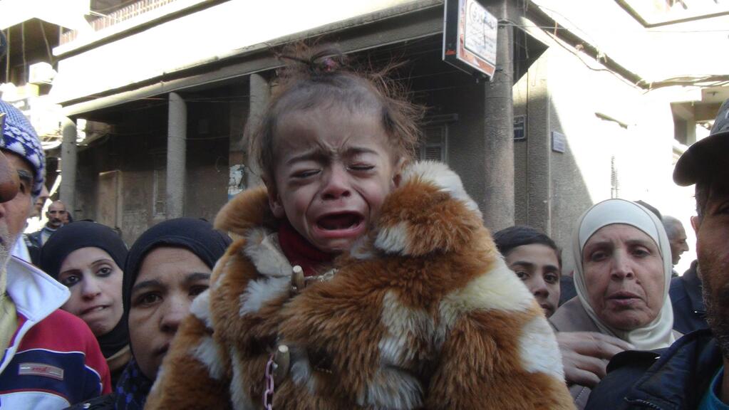 A malnourished child cries in the Yarmouk camp for Palestinians on the outskirts of the Syrian capital Damascus