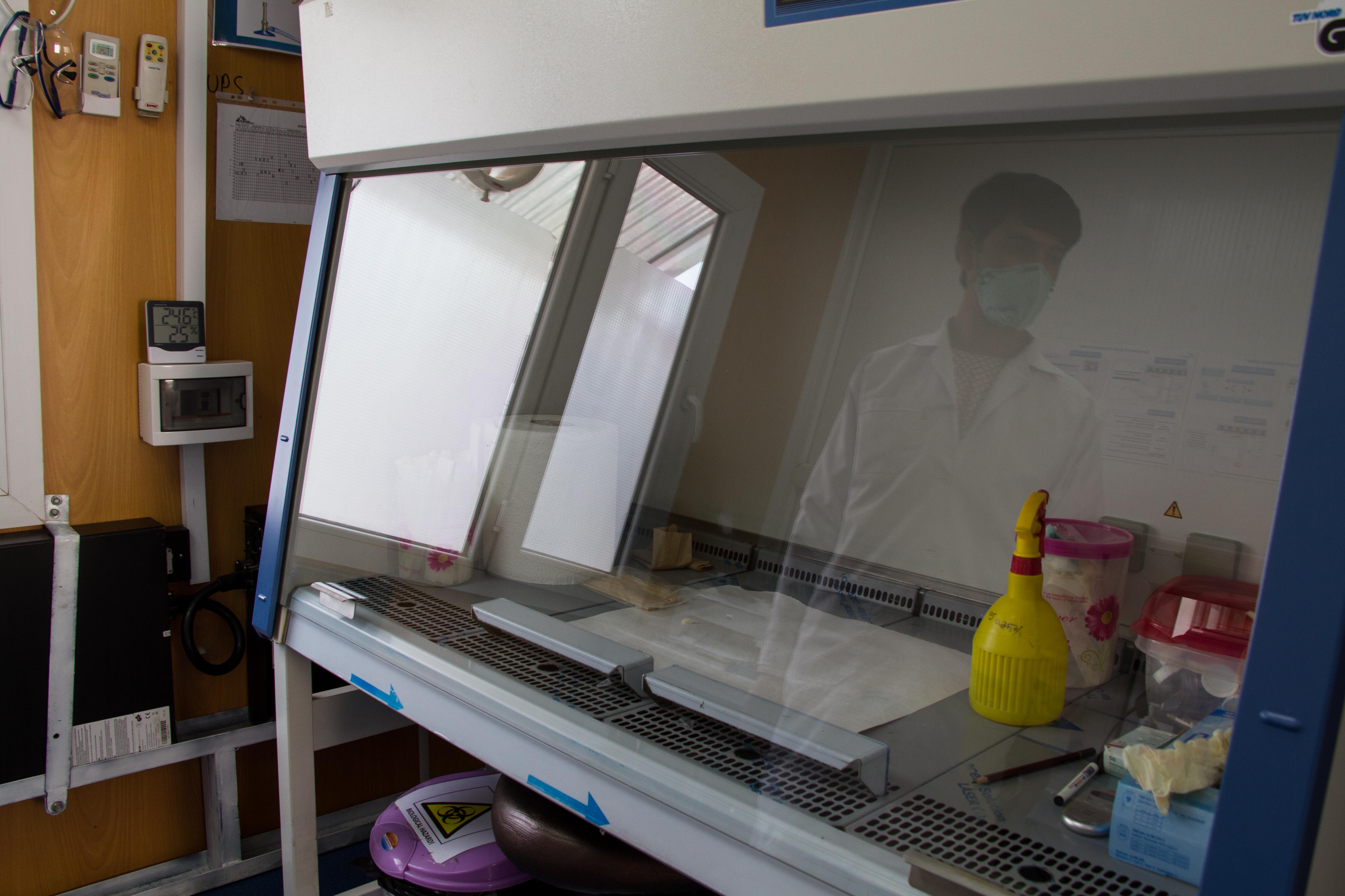Equipment used to test for TB