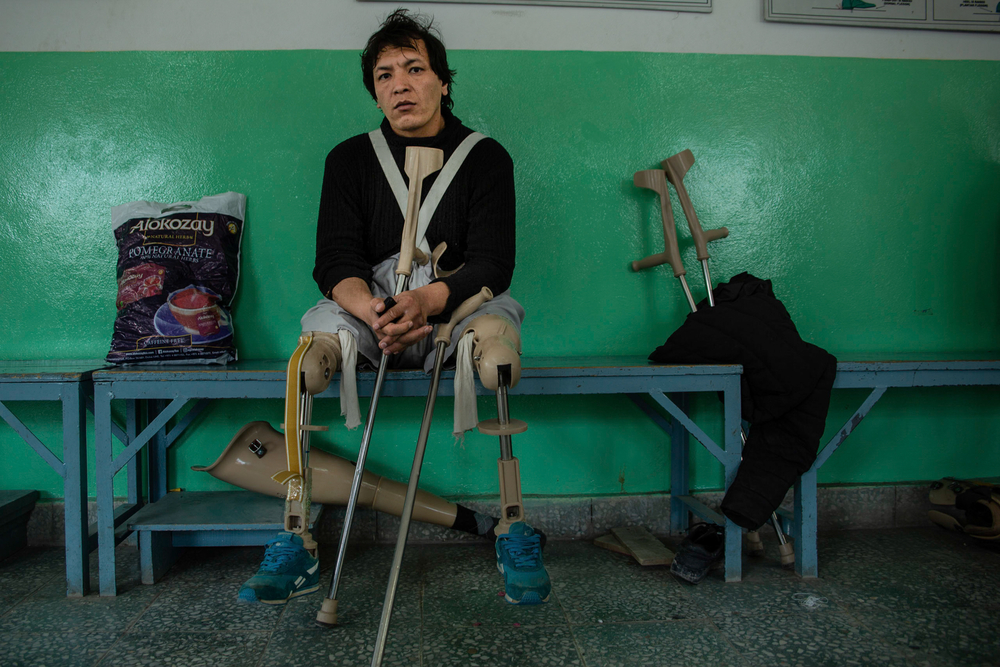 A man with prosthetic legs sits on a bench in a medical facility