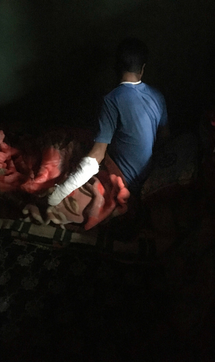 A man who asked not to be identified shows his injuries at his home in Shopian village. The man says soldiers tortured him in September.