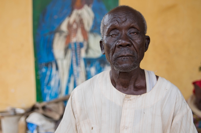 Juda has gone blind over the past year