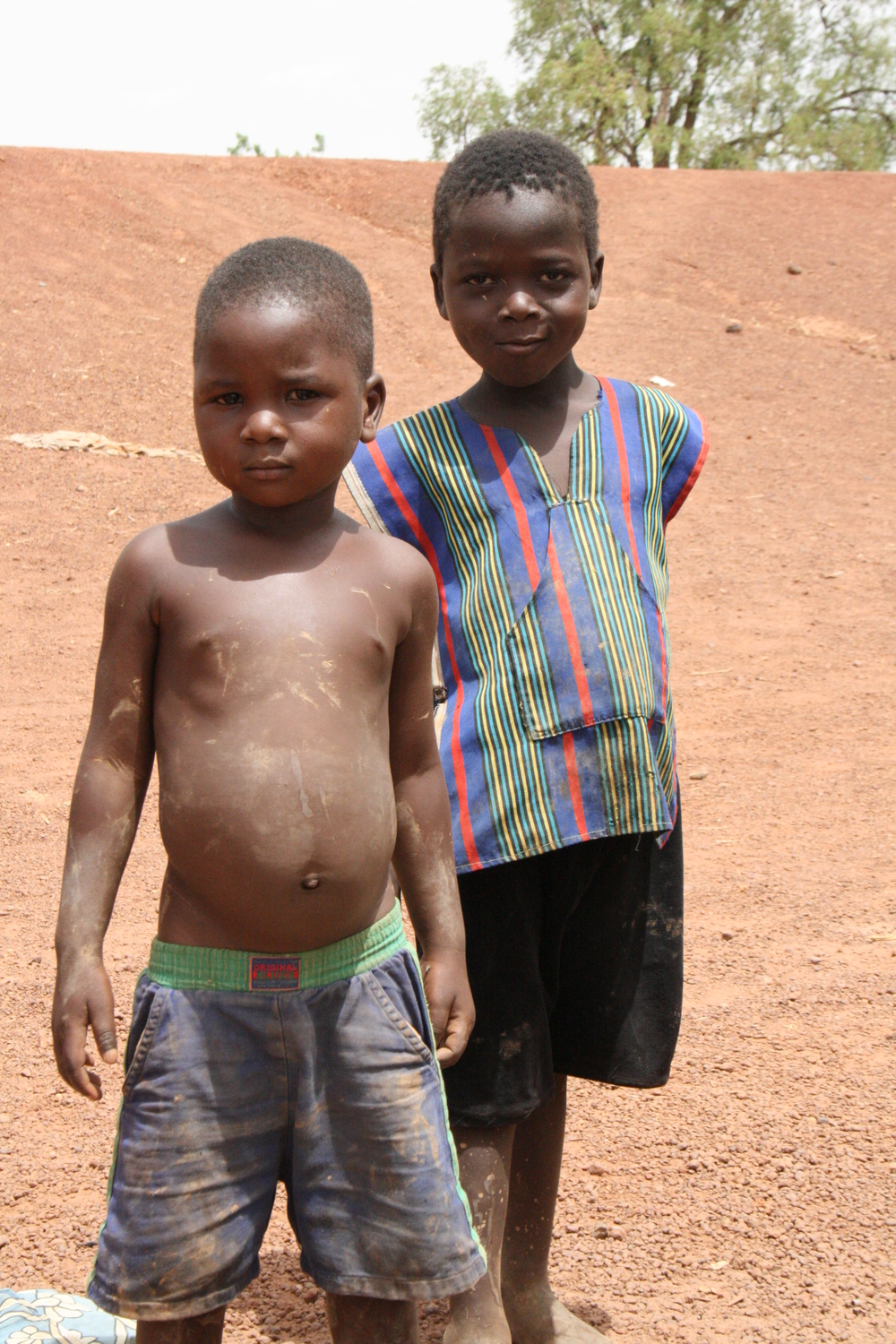 Burkina Faso's government says 23 percent acute malnutrition is not a crisis. Aid agencies say the government is the obstacle to making progress.